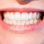 Aktualna technologia używana w salonach stomatologii estetycznej zdoła sprawić, że odbierzemy śliczny uśmiech.