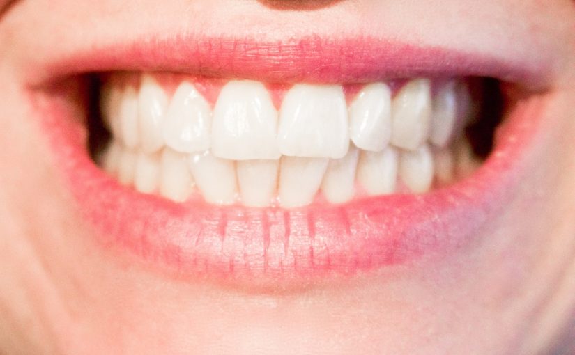 Aktualna technologia używana w salonach stomatologii estetycznej zdoła sprawić, że odbierzemy śliczny uśmiech.